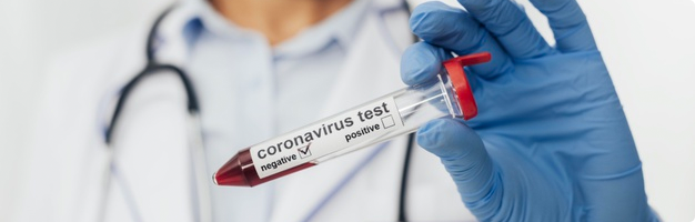 Teste pentru diagnosticarea COVID-19